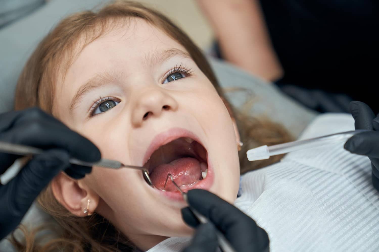 8 Adımda Çocuklarda Arka Diş Eti Şişmesi Tedavisi